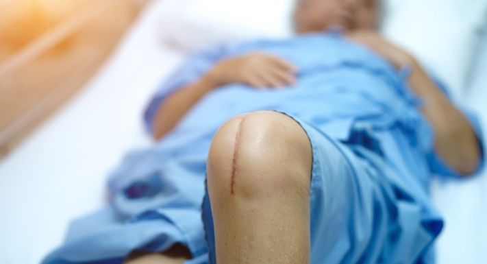What To Do if You Had an Unnecessary Surgery