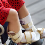 A small child in a red dress with black hearts buckled into a wheelchair. There are braces on both of the child's legs.