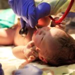 A newborn baby lying on their back beneath a light. People wearing surgical gloves check the baby's vital signs.