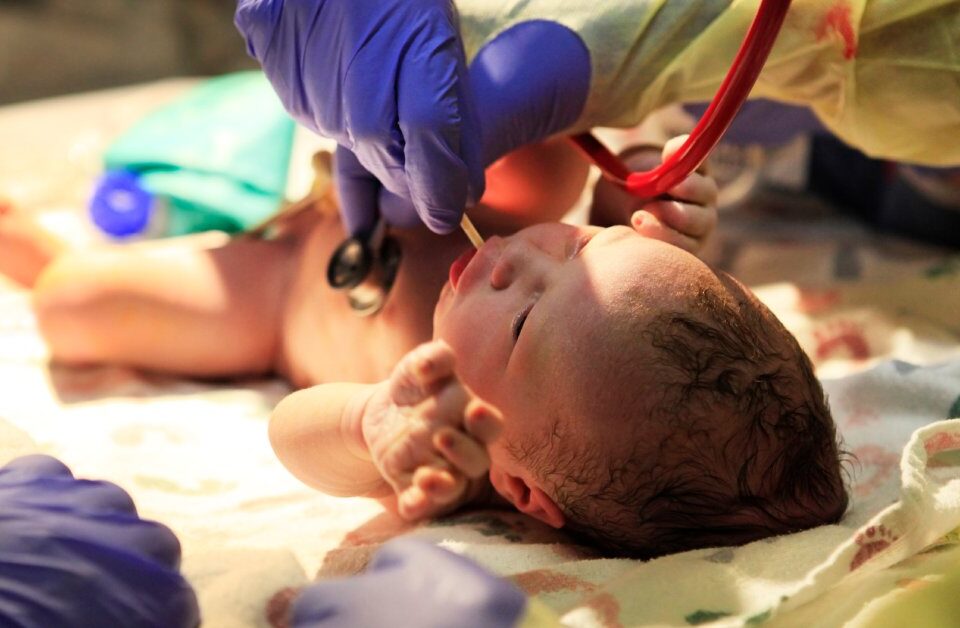 A newborn baby lying on their back beneath a light. People wearing surgical gloves check the baby's vital signs.