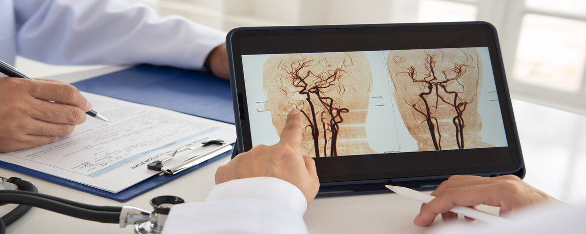 A person at a table gestures at a digital tablet that displays images from a brain scan. Another person fills out paperwork.