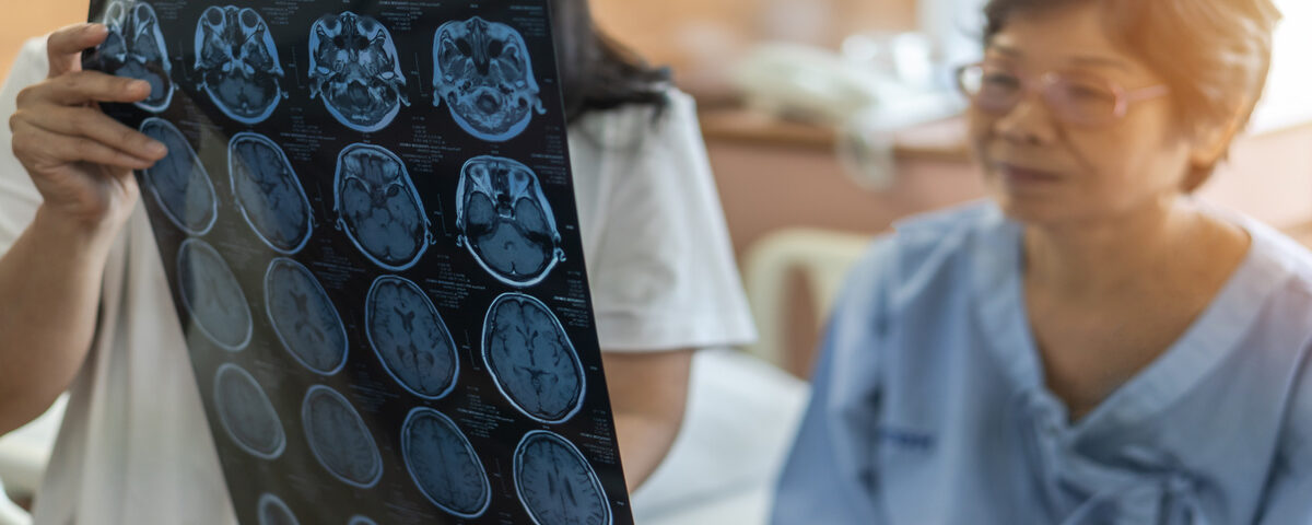 A doctor holds up a sheet with a series of MRI images of the brain and shows it to the patient, a woman with glasses.